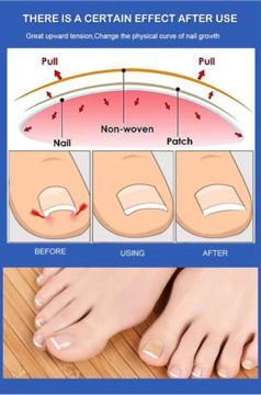 3 In 1 Toenails Corrector