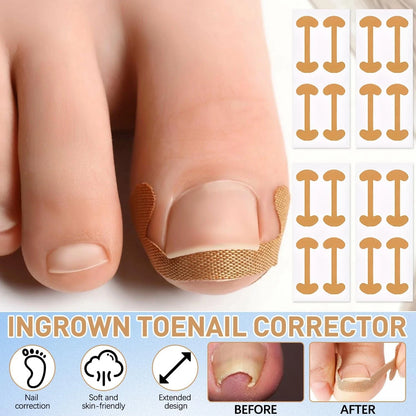 3 In 1 Toenails Corrector